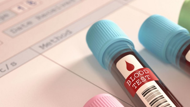 Los casos de sífilis, aumentaron un 30% en Mendoza